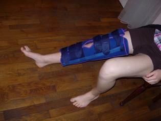 النقاهة بعد كسر الرضفة